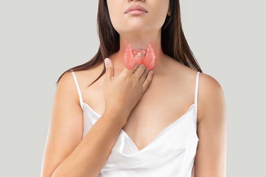 Hypothyroidism