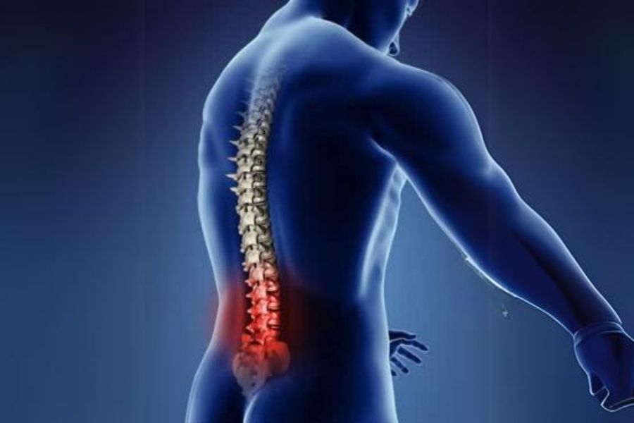Lumbar Spondylitis