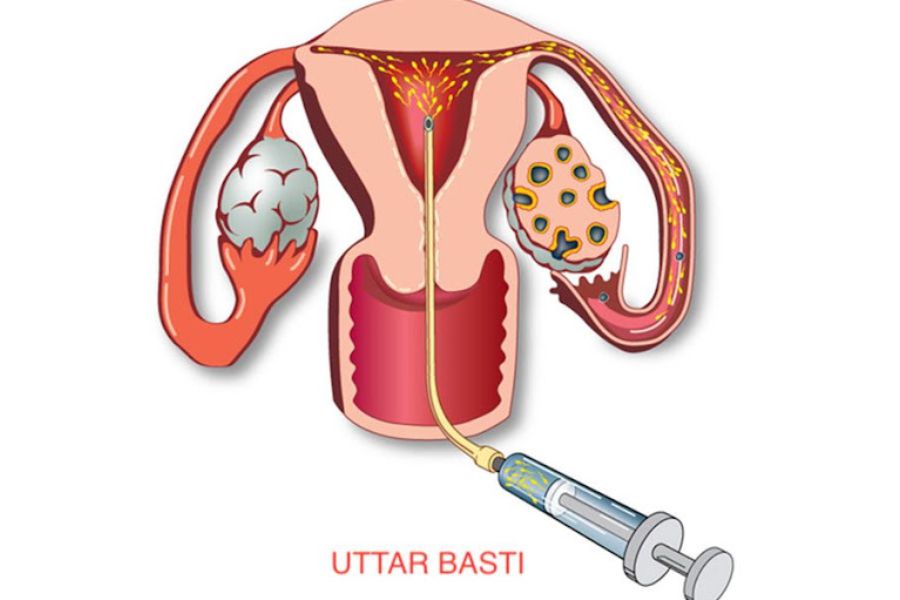 Uttarbasti